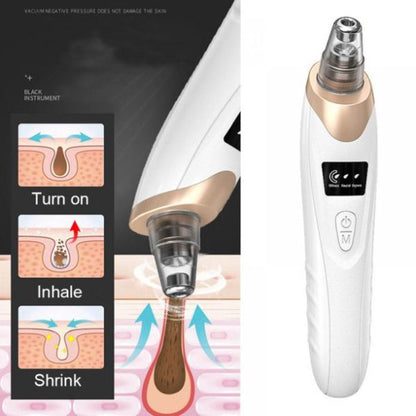 Electric Blackhead Suction Remover - Portable Pore Cleaner